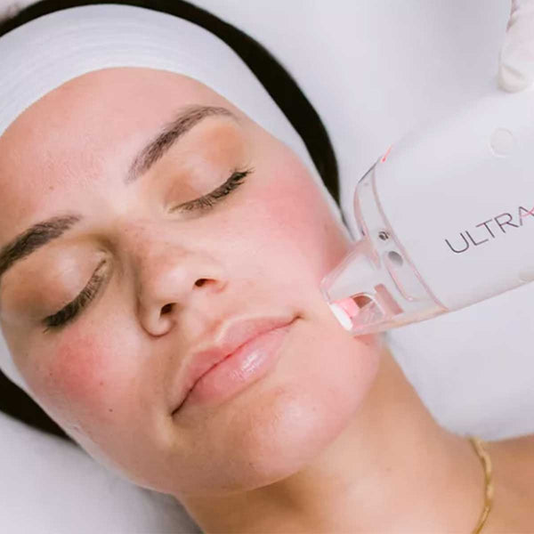 LASER FACIAL (PHOTOFACIAL) - NC