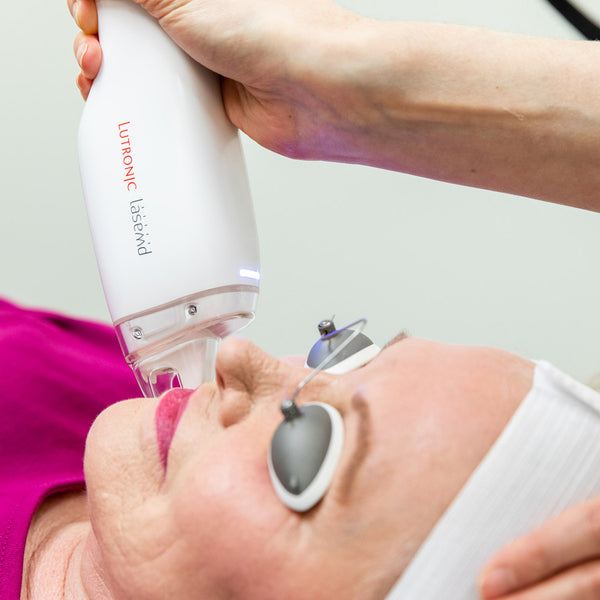 FRACTIONAL LASER FACIAL